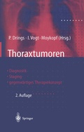 Bild: Thoraxtumoren - Springer