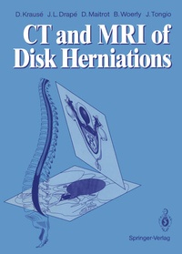 Enlarge image Cover: CT and MRI of Disk Herniations - Springer