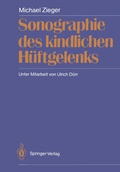 Cover: Sonographie des kindlichen H&uuml;ftgelenks - Springer