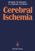Bild: Cerebral Ischemia - Springer
