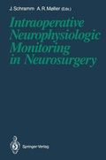 Bild: Intraoperative Neurophysiologic Monitoring in Neurosurgery - Springer