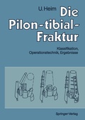 Cover: Die Pilon-tibial-Fraktur - Springer