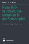 Cover: Neue Bildverarbeitungstechniken in der Sonographie - Springer