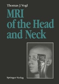 Cover: MRI of the Head and Neck - Springer