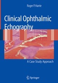 Cover: Clinical Ophthalmic Echography - Springer