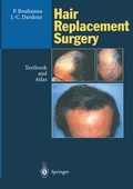 Cover: Hair Replacement Surgery - Springer