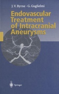 Cover: Endovascular Treatment of Intracranial Aneurysms - Springer