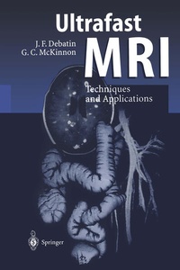 Enlarge image Cover: Ultrafast MRI - Springer