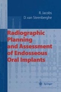 Cover: Radiographic Planning and Assessment of Endosseous Oral Implants - Springer
