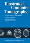 Cover: Illustrated Computer Tomography - Springer