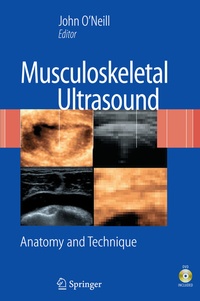 Abbildung von: Musculoskeletal Ultrasound - Springer