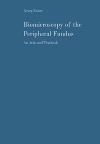 Enlarge image Cover: Biomicroscopy of the Peripheral Fundus - Springer