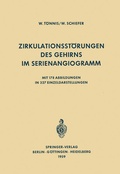 Cover: Zirkulationsst&ouml;rungen des Gehirns im Serienangiogramm - Springer