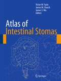 Bild: Atlas of Intestinal Stomas - Springer