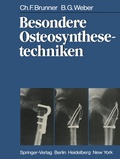 Cover: Besondere Osteosynthesetechniken - Springer