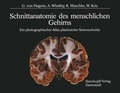 Cover: Schnittanatomie Des Menschlichen Gehirns - Steinkopff-Verlag Darmstadt