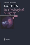 Cover: Lasers in Urological Surgery - Springer