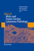 Cover: Atlas of Mohs and Frozen Section Cutaneous Pathology - Springer
