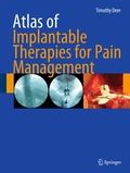 Cover: Atlas of Implantable Therapies for Pain Management - Springer