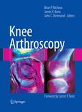 Cover: Knee Arthroscopy - Springer