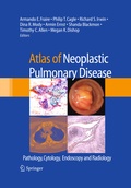 Cover: Atlas of Neoplastic Pulmonary Disease - Springer