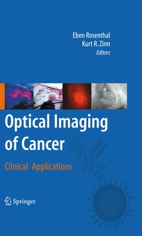 Abbildung von: Optical Imaging of Cancer - Springer