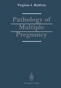 Abbildung von: Pathology of Multiple Pregnancy - Springer