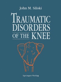 Abbildung von: Traumatic Disorders of the Knee - Springer
