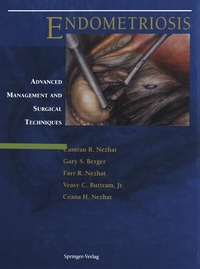 Abbildung von: Endometriosis - Springer