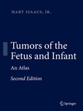 Bild: Tumors of the Fetus and Infant - Springer