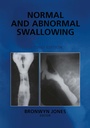 Cover: Normal and Abnormal Swallowing - Springer