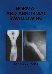 Abbildung von: Normal and Abnormal Swallowing - Springer