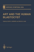 Cover: ART and the Human Blastocyst - Springer