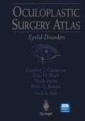 Cover: Oculoplastic Surgery Atlas - Springer