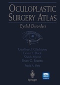 Cover: Oculoplastic Surgery Atlas - Springer