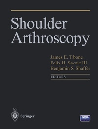 Abbildung von: Shoulder Arthroscopy - Springer