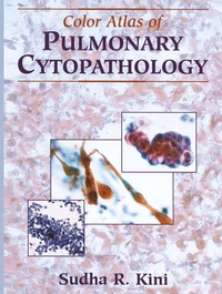 Abbildung von: Color Atlas of Pulmonary Cytopathology - Springer