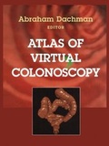 Cover: Atlas of Virtual Colonoscopy - Springer