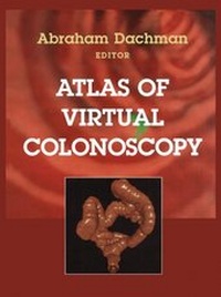 Enlarge image Cover: Atlas of Virtual Colonoscopy - Springer