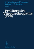 Cover: Proliferative Vitreoretinopathy (PVR) - Springer