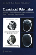 Cover: Craniofacial Deformities - Springer