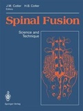 Cover: Spinal Fusion - Springer