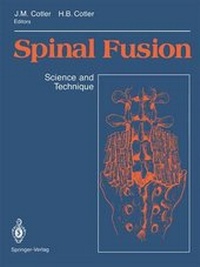 Enlarge image Cover: Spinal Fusion - Springer