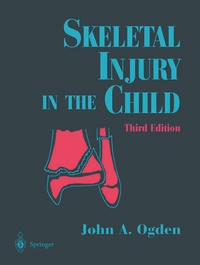 Abbildung von: Skeletal Injury in the Child - Springer