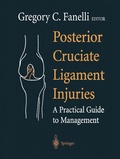 Cover: Posterior Cruciate Ligament Injuries - Springer