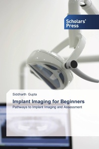 Enlarge image Cover: Implant Imaging for Beginners - Scholars' Press