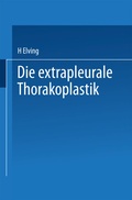 Bild: Die extrapleurale Thorakoplastik - Springer