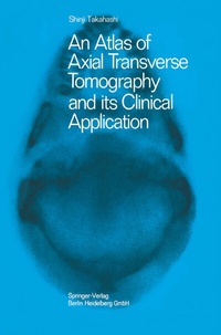 Abbildung von: An Atlas of Axial Transverse Tomography and its Clinical Application - Springer
