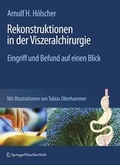 Cover: Rekonstruktionen in Der Viszeralchirurgie - Springer