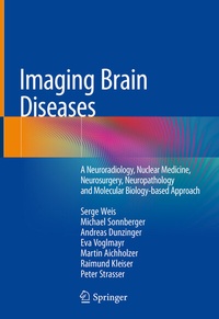 Abbildung von: Imaging Brain Diseases - Springer